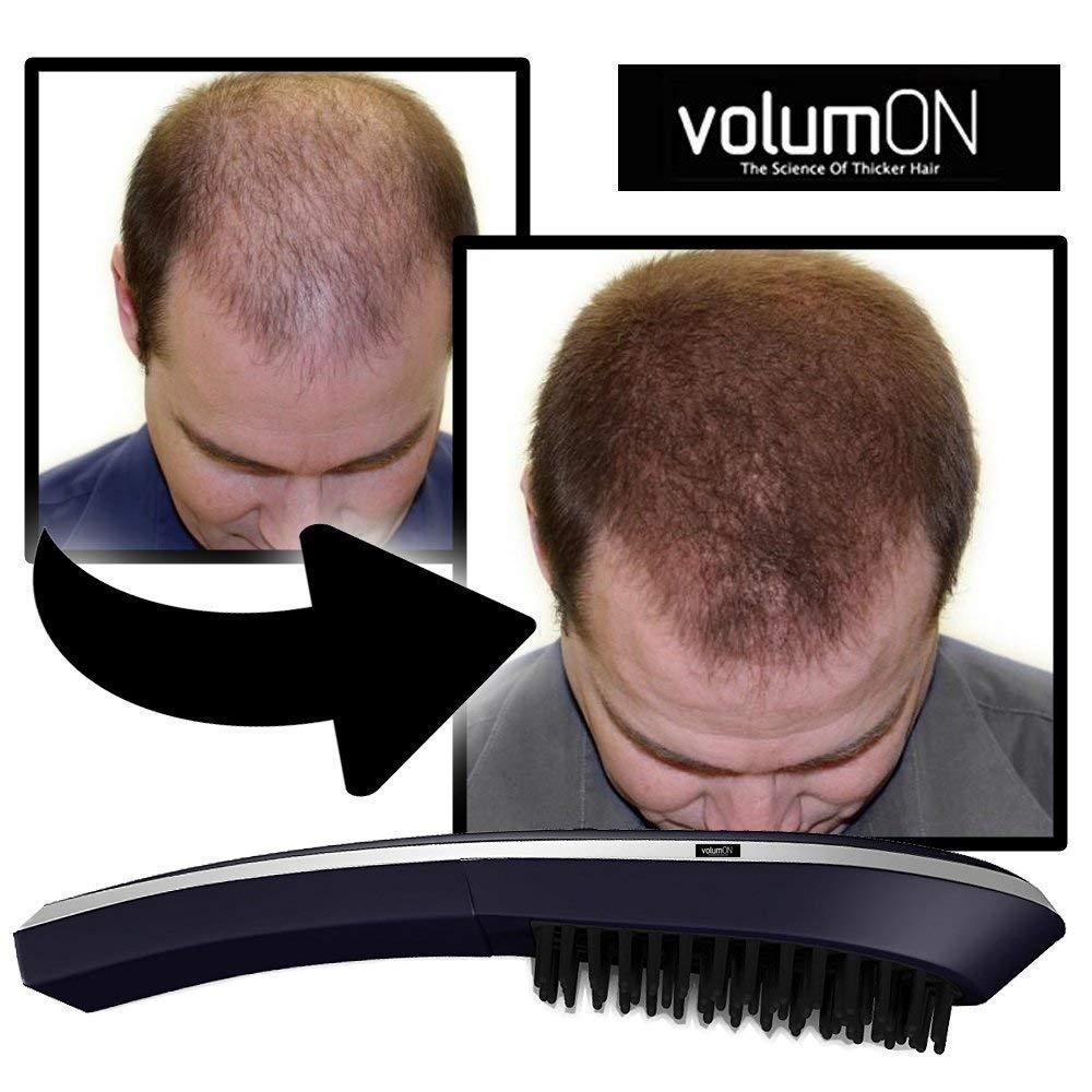 Volumon Laser Hair Massage Comb – Stimulate Hair Growth & Boost Scalp Health