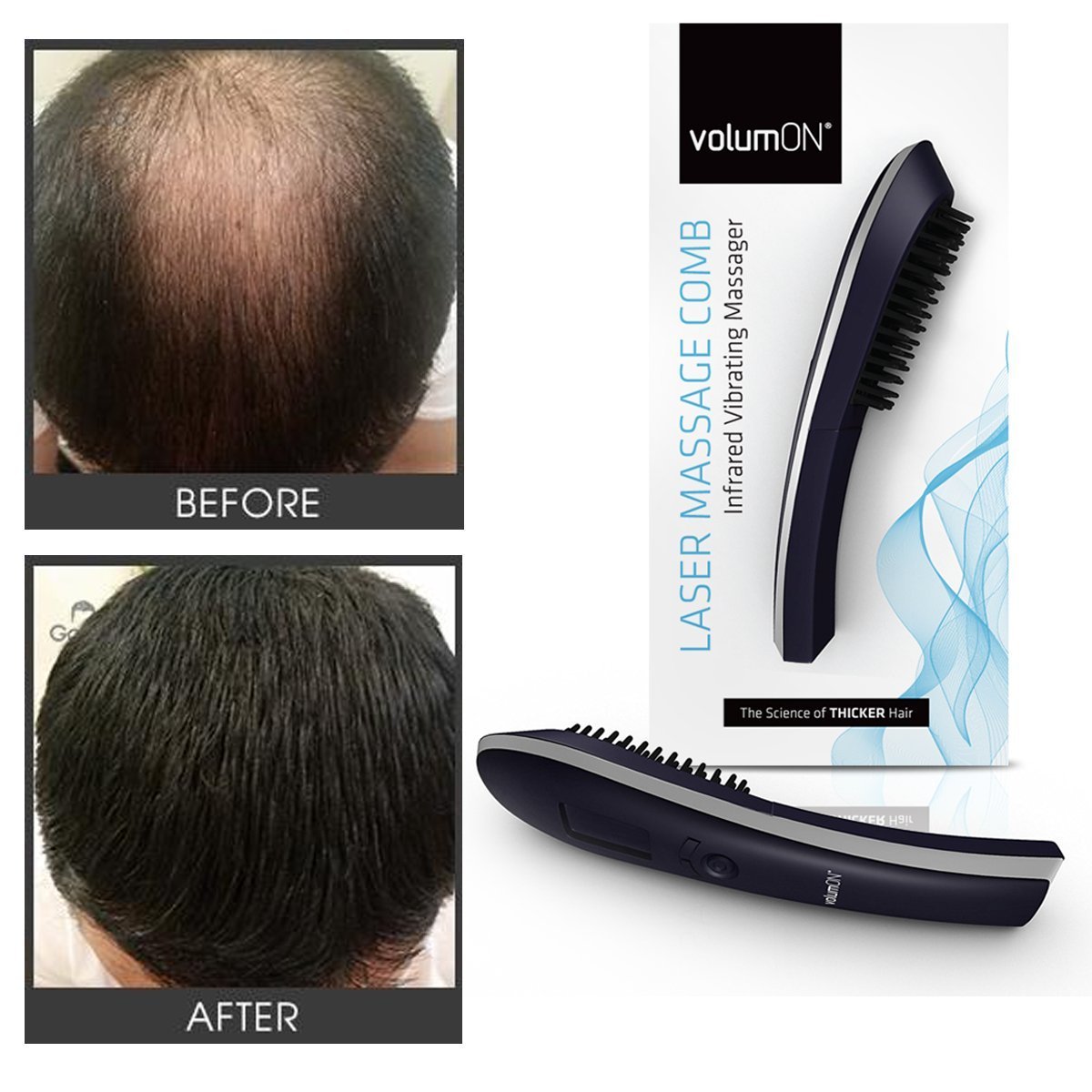 Volumon Laser Hair Massage Comb – Stimulate Hair Growth & Boost Scalp Health