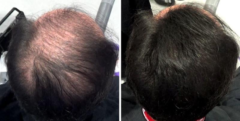 Volumon Hair Building Fibres - KERATIN 28g