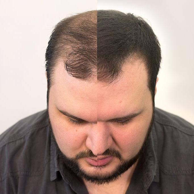 Volumon Hair Building Fibres - KERATIN 28g