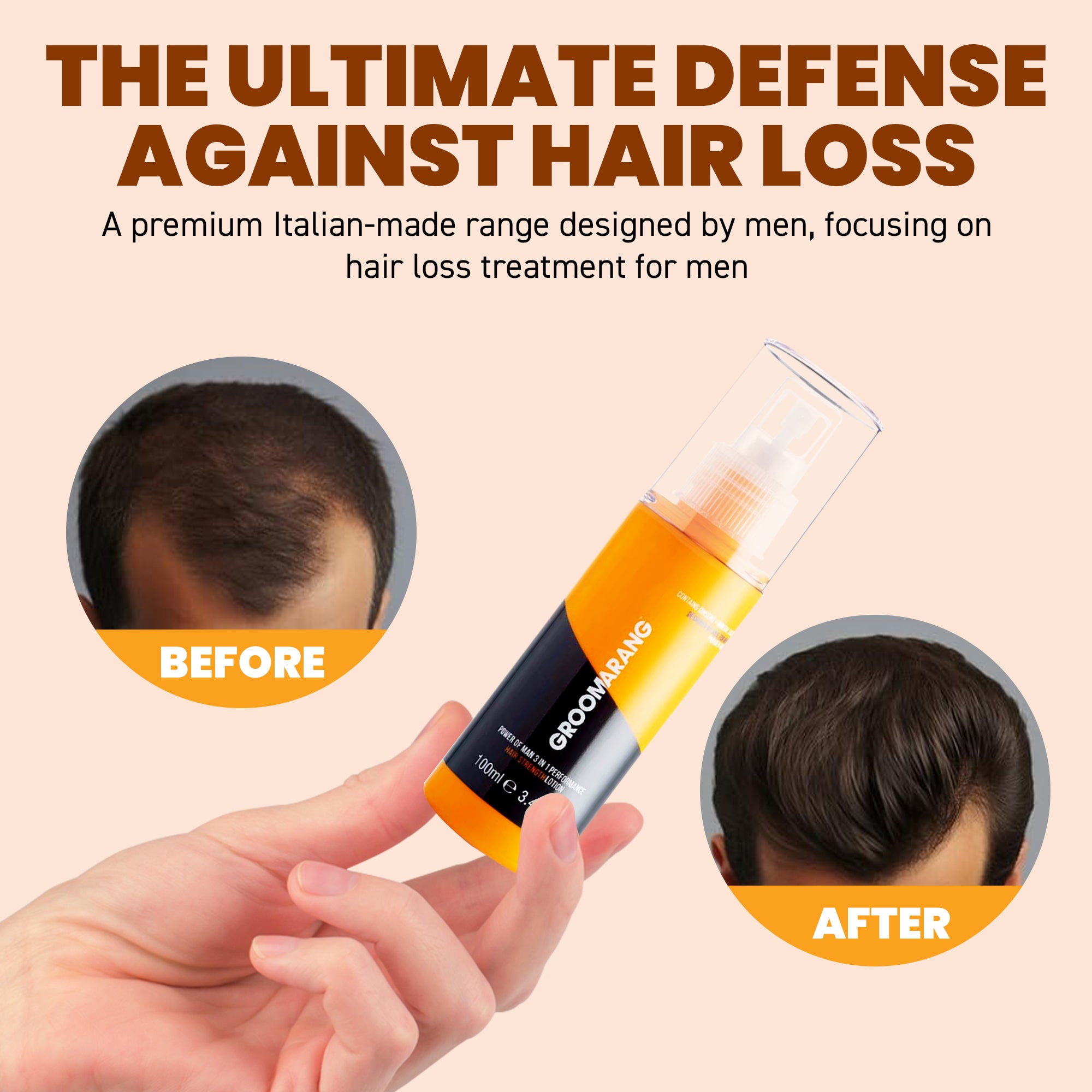 Groomarang 'Power of Man' Hair and Beard Growth Kit- Groomarang Power of Man 3 in 1 Performance 'Hairloss Prevention Lotion' 100ml + Groomarang 'Rock n Roll' Beard and Hair Growth Roller - 0.5mm