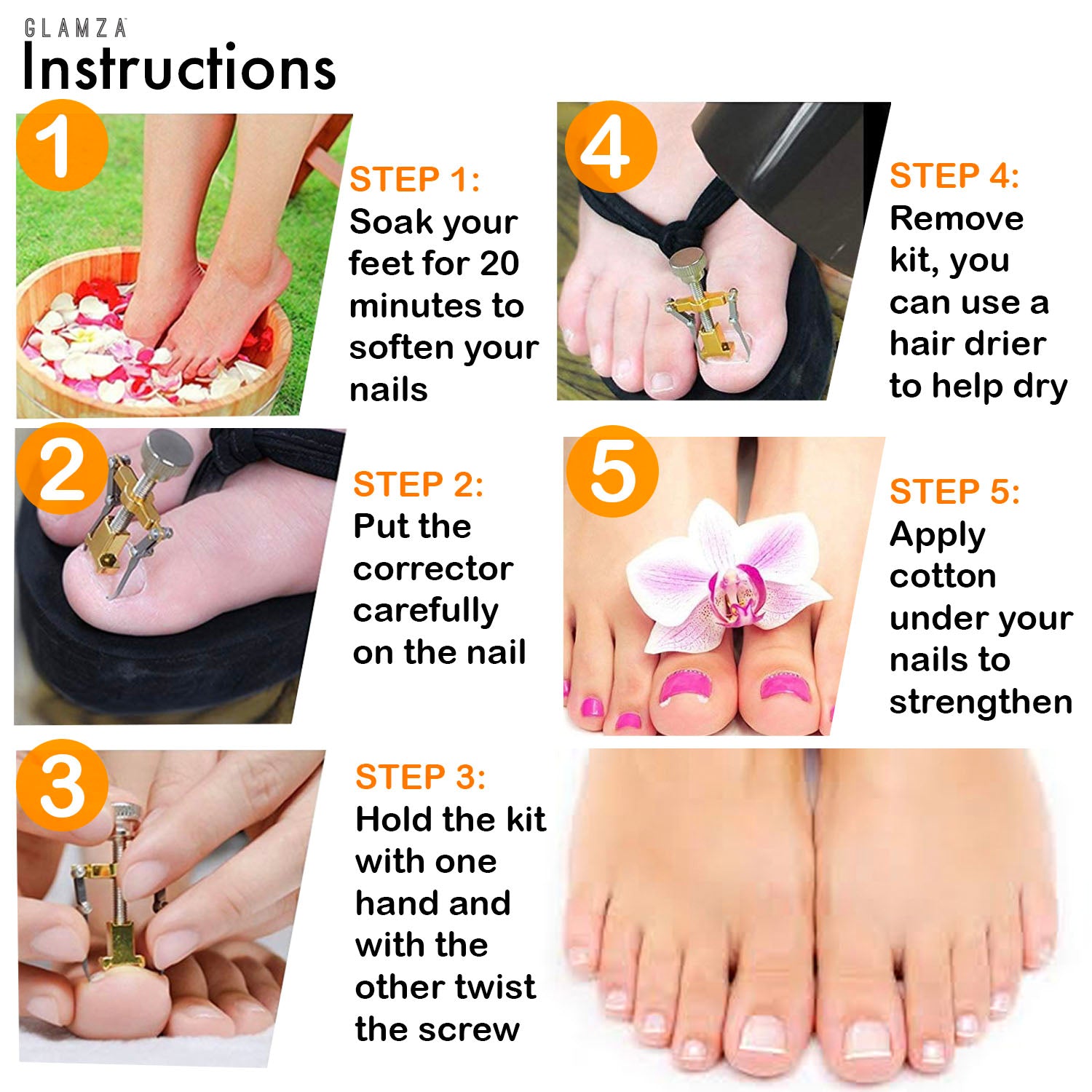 Ingrown Toenail Corrector Clamps – Professional Relief & Nail Reshaping Tool