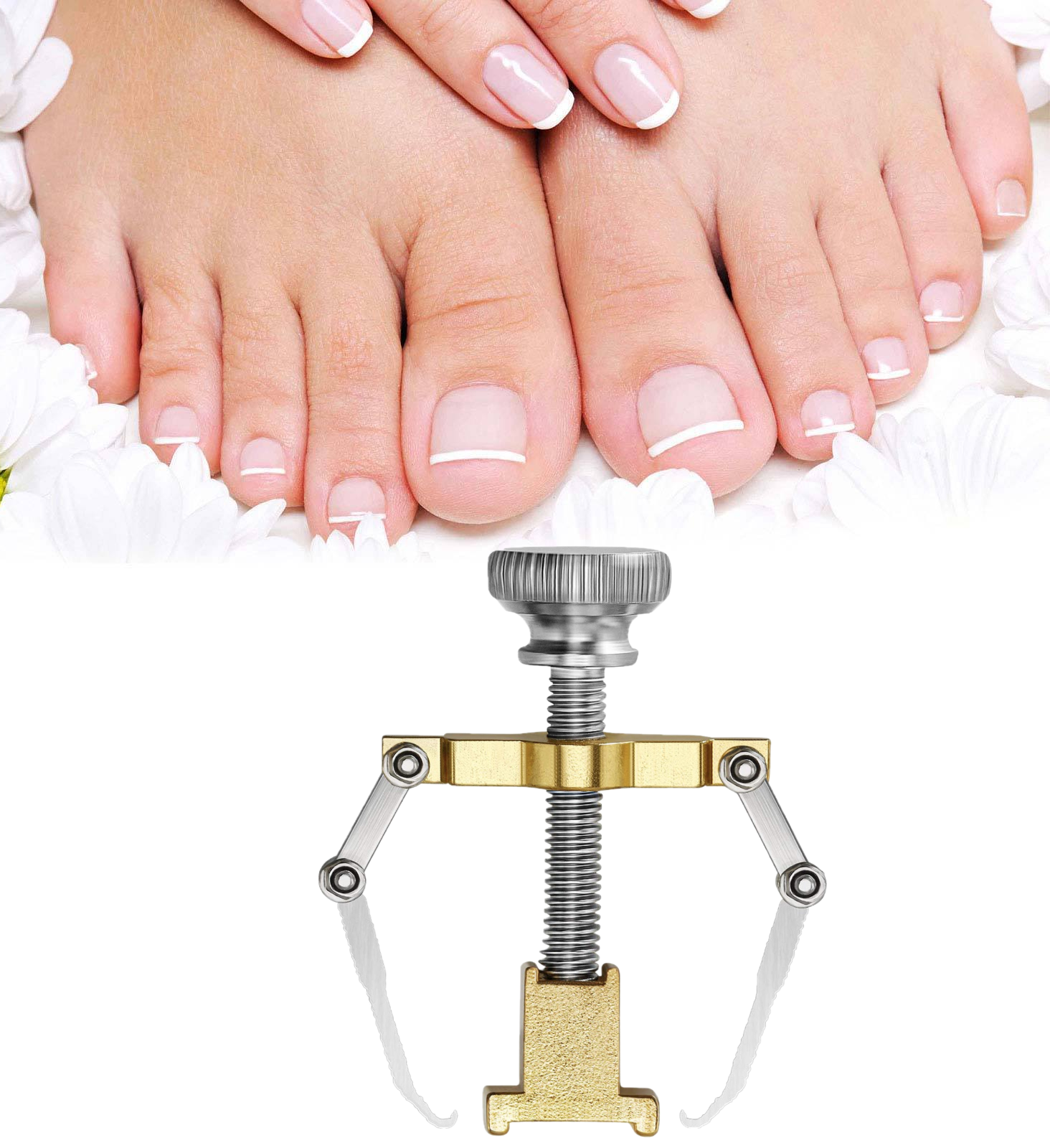 Ingrown Toenail Corrector Clamps – Professional Relief & Nail Reshaping Tool