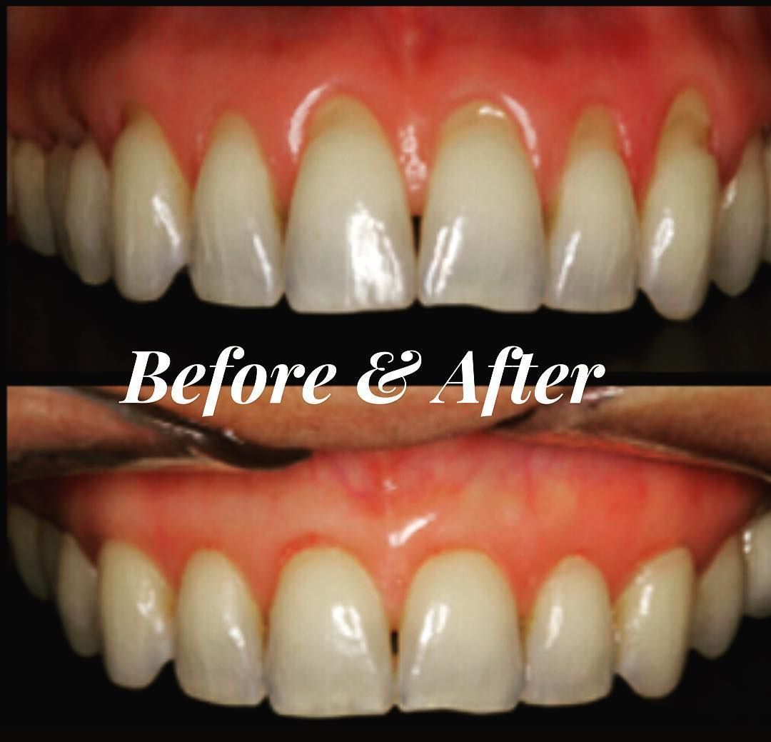 Herbal Dentist Tooth and Gum Oil 30ml