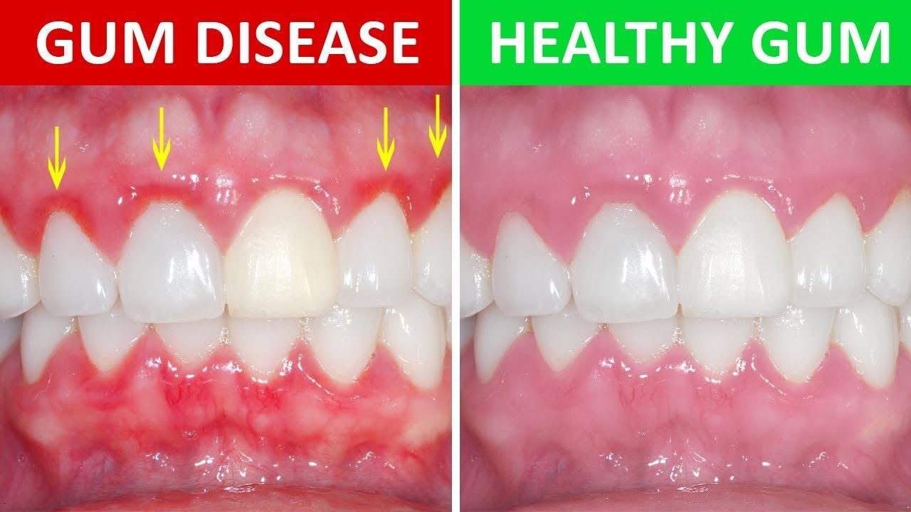Herbal Dentist Tooth and Gum Oil 30ml