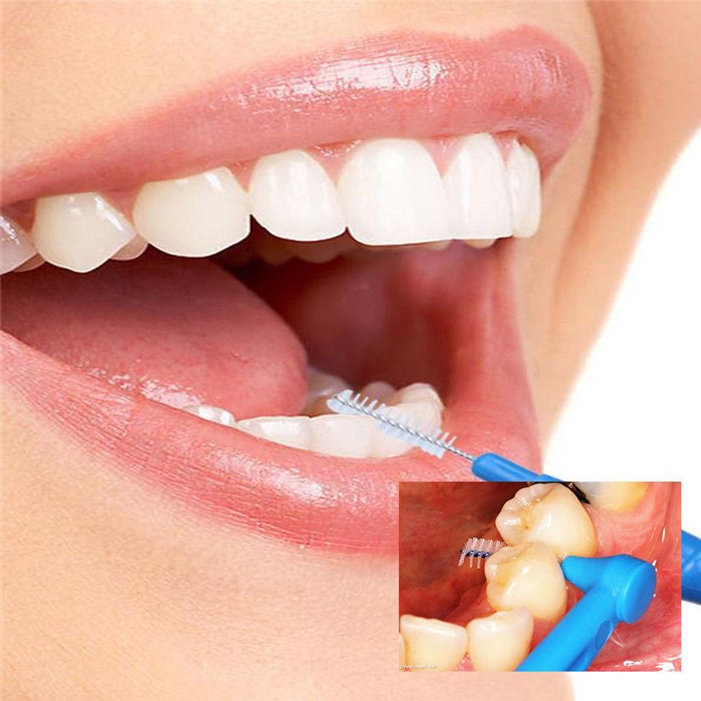 Glamza Interdental Toothbrushes 5 Pack