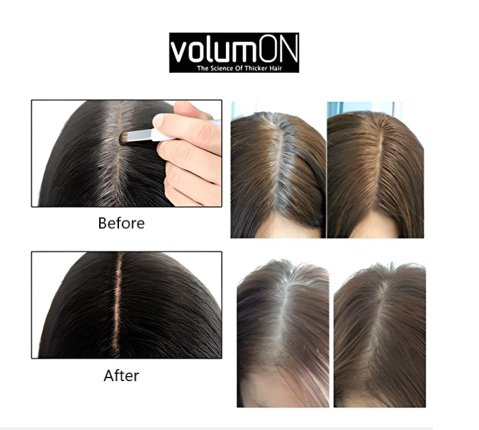 Hair Loss Concealer and Root Cover Up Kit